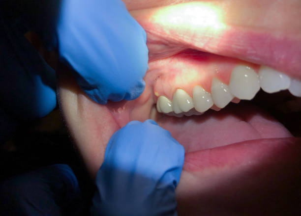 Best Pediatric Emergency Dentist in Chariton, IA